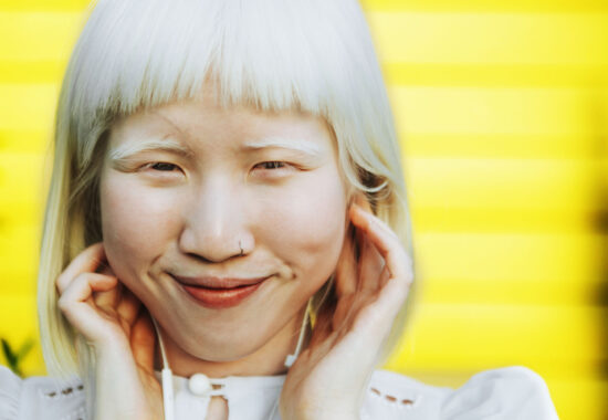 Cute albino girl listening to her favorite music through earphon